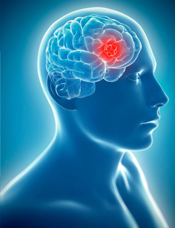 Neurosrugery & Spine Oncology Neurosrugery & Spine Oncology